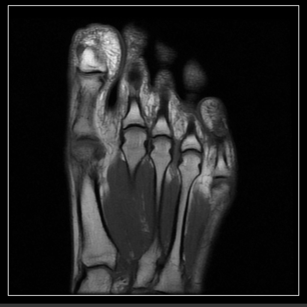 Paused, But Not&nbsp;Done